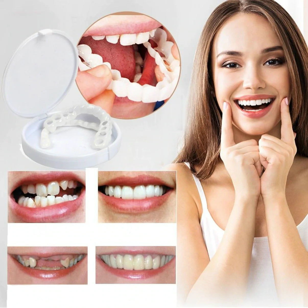 White Teeth Facings | Klikbaar