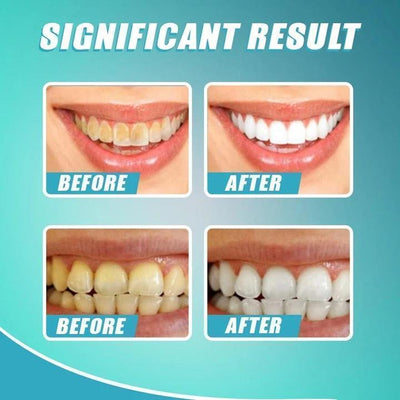 WhiteSmile | Whitening Color Corrector voor wittere tanden (1+1 GRATIS)