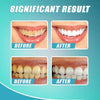 WhiteSmile | Whitening tandpasta voor wittere tanden (1+1 GRATIS)