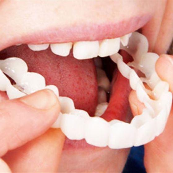White Teeth Facings | Klikbaar