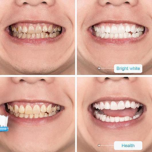 WhiteSmile | Whitening Color Corrector voor wittere tanden (1+1 GRATIS)